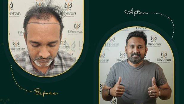 Dheeran Clinic Coimbatore