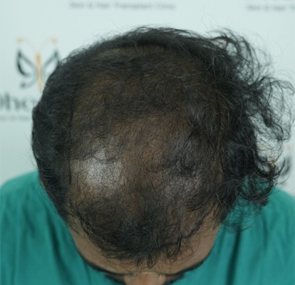 before after (2)