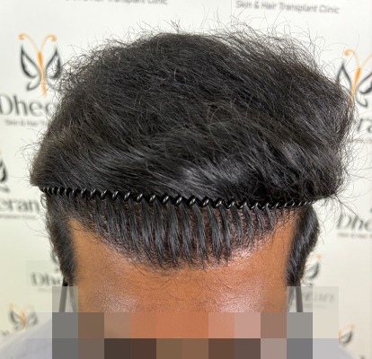 before after (4)