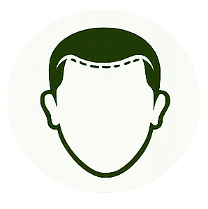 Hairline Correction