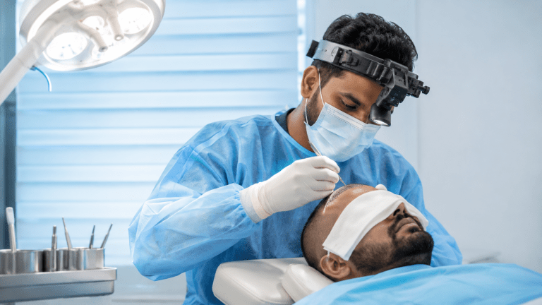 Hair Transplant in Coimbatore: Complete Guide to FUE Surgery