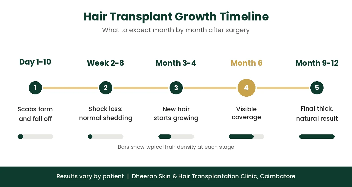 Hair transplant growth timeline from day 1 to month 12