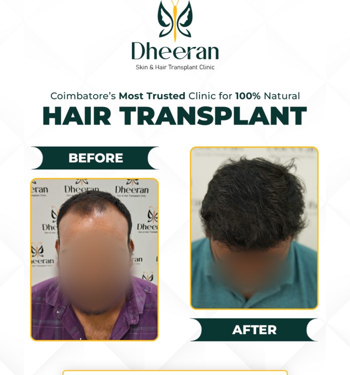 05 - Gowtham Before After