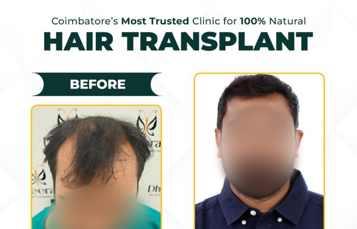10 - Suresh babu Before After