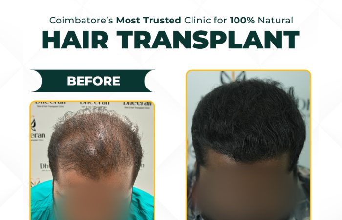 11 - Vignesh Before After